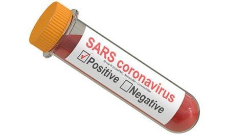 Intervención de los centros privados que realizan tests de coronavirus  por el gobierno y regularización de los precios