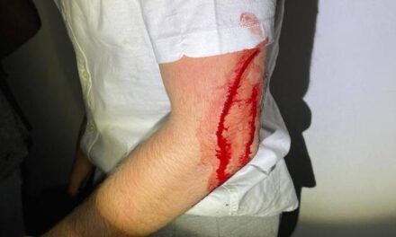 Varios heridos en una pelea con navajas, botellas y piedras en San Javier